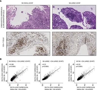 Paired Rheumatoid Arthritis Synovial Biopsies From Small and Large Joints Show Similar Global Transcriptomic Patterns With Enrichment of Private Specificity TCRB and TCR Signaling Pathways